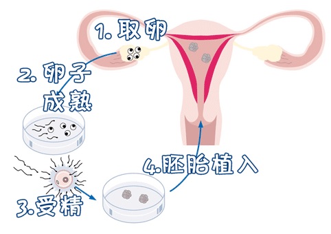 供卵代怀包生男孩机构